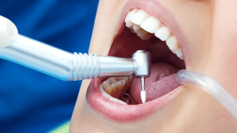 a saddleback dental patient getting a root canal in mission viejo